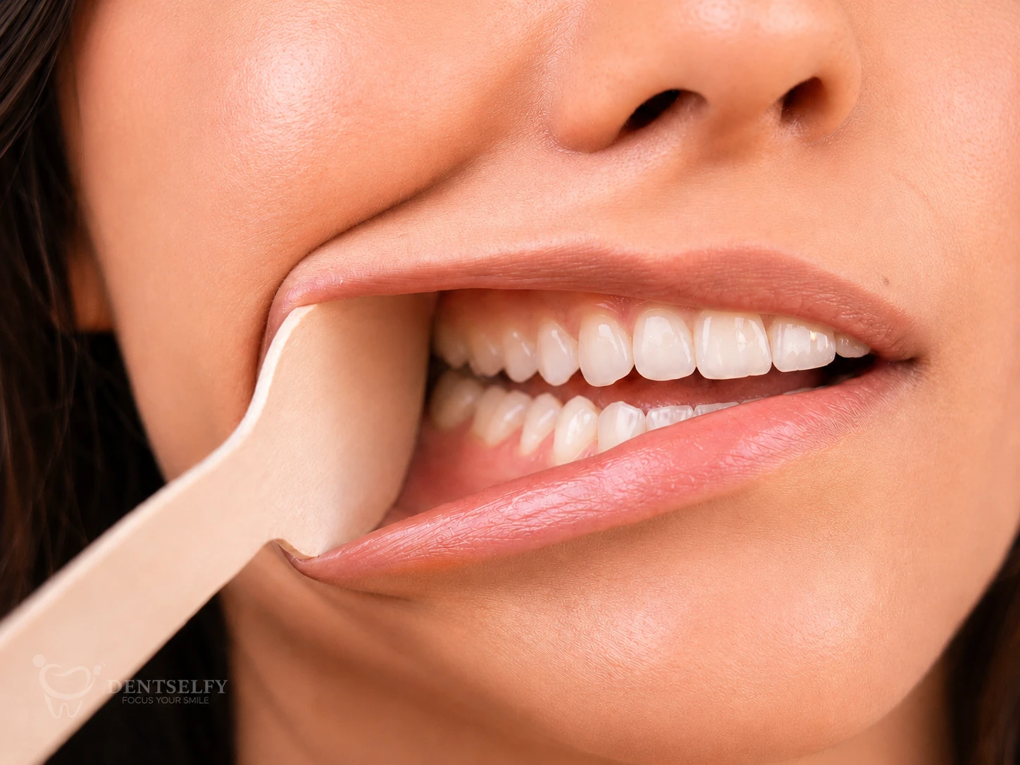 Right side smile — cheek gently pulled, right-side teeth visible