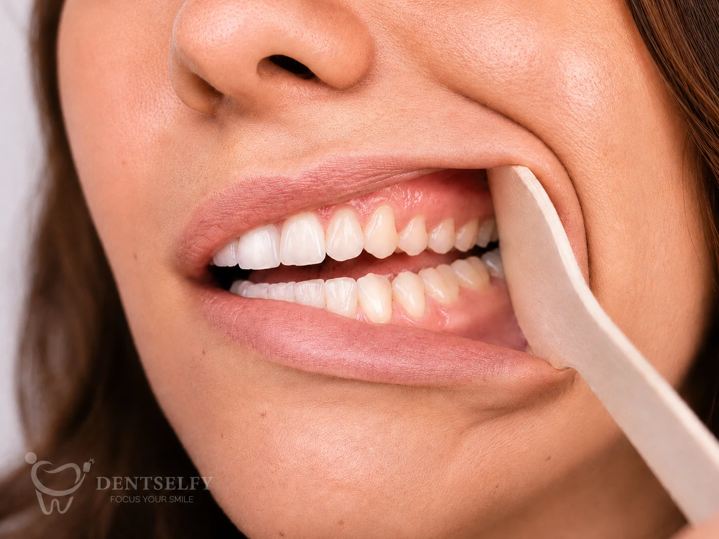 Left side smile — cheek gently pulled, left-side teeth visible